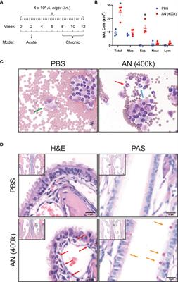 STAT6 Blockade Abrogates Aspergillus-Induced Eosinophilic Chronic Rhinosinusitis and Asthma, A Model of Unified Airway Disease